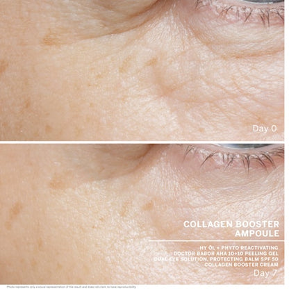 Collagen Booster Ampül